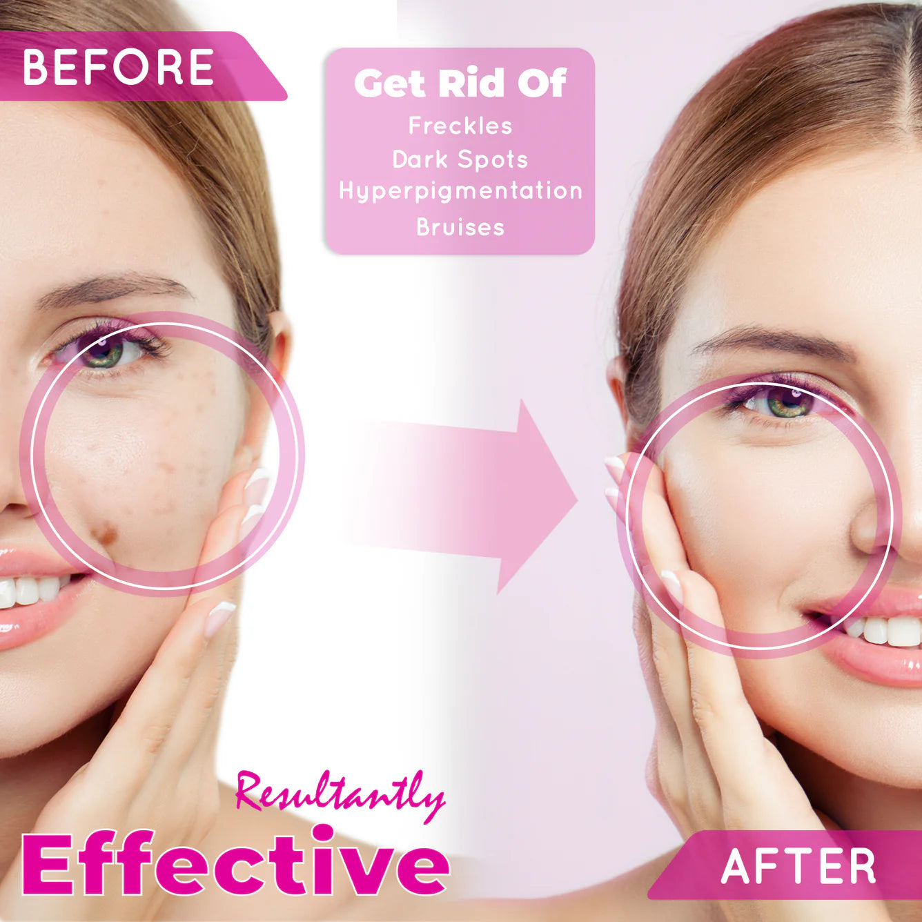 Fair & White So White Skin Perfector Gel - Dark Spot Remover