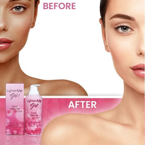 LightenUp Girl! Intense Perfection Lotion 400ml | 13.52oz