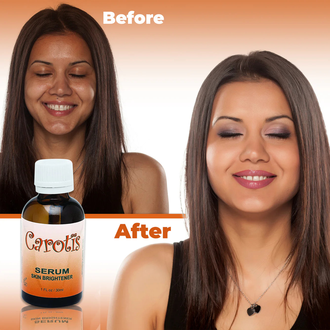 Carotis Brightening Serum