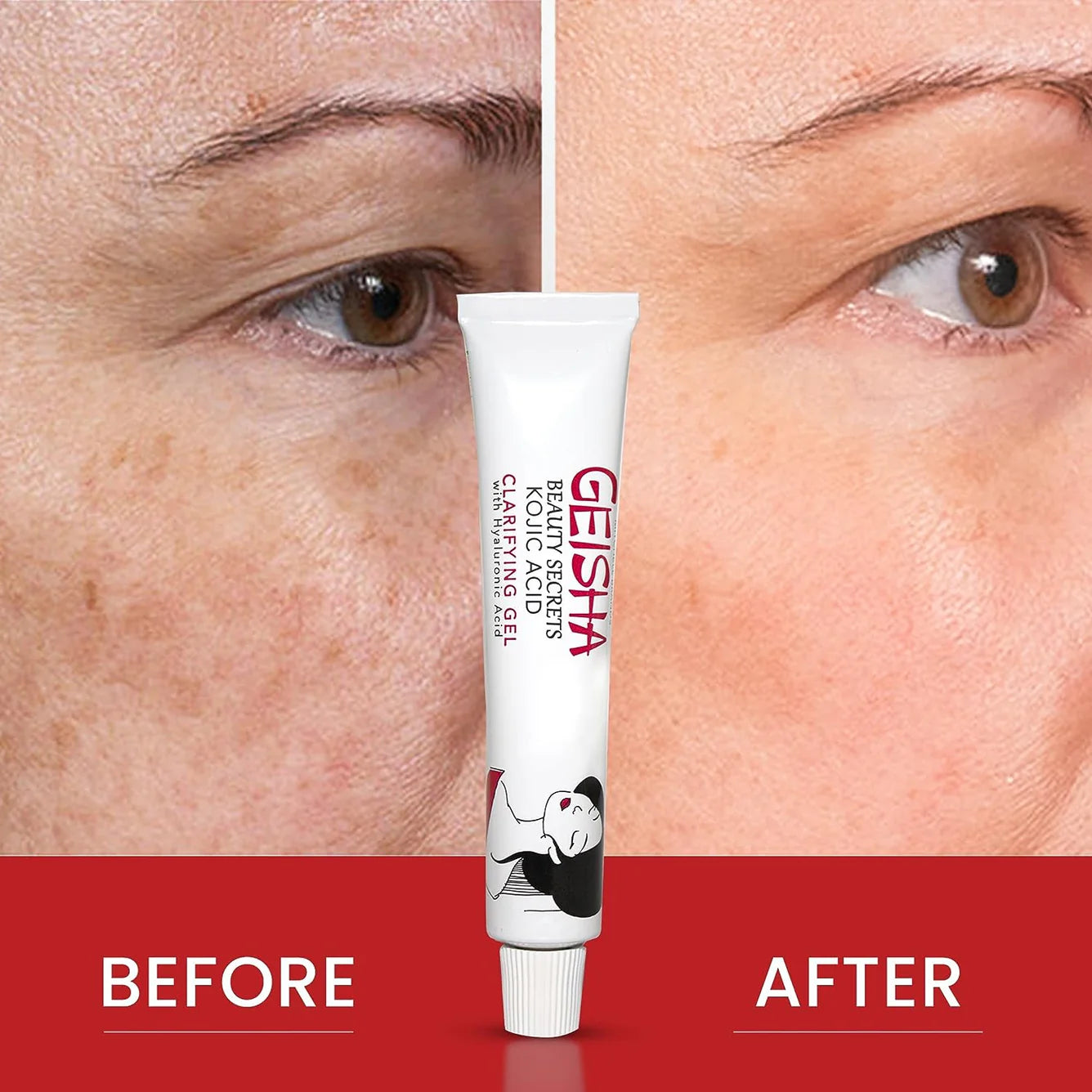 Geisha Clarifying Gel with Kojic Acid & Hyaluronic Acid 30g