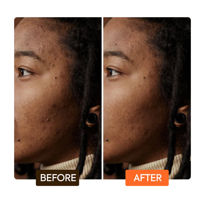 Argon & Carrot Oil Radiance-Boosting Serum