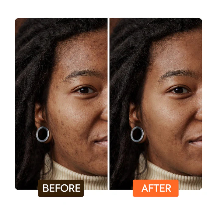 Extreme Argan & Carrot Oil Multi Function Soap