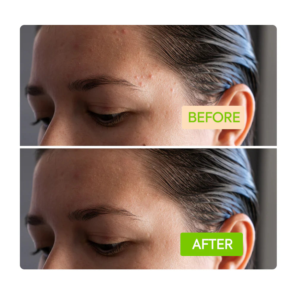 Ginger Cleansing Bar - IYKYK