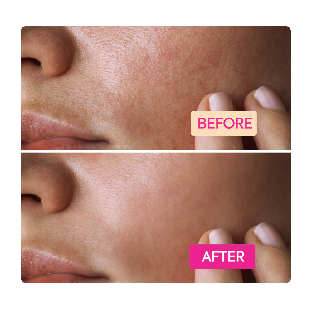 Niacinamide Facial Cleansing Bar - IYKYK